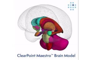 New ClearPoint Neuro software wins FDA clearance, used in first cases