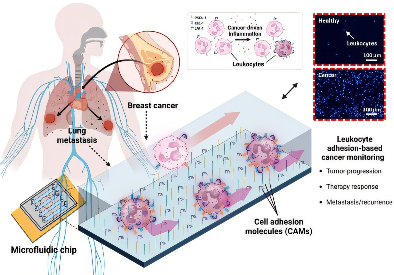 Chip tracks cancer - Start Medical Product Development